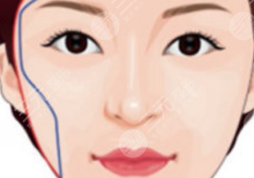 面部輪廓固定怎么做？