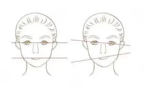 臉歪大小臉怎么矯正？