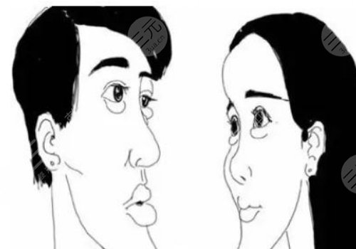 月亮臉矯正手術(shù)多少錢？