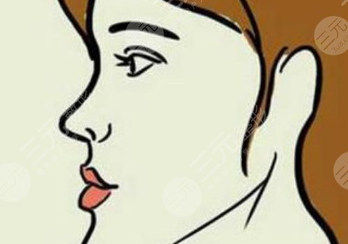 月亮臉矯正手術(shù)多少錢？