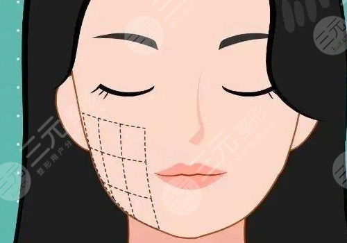 黑金dpl超光子嫩膚效果怎么樣