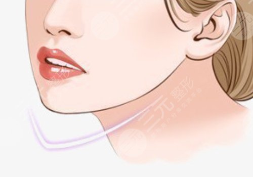 內(nèi)輪廓和外輪廓的位置區(qū)別