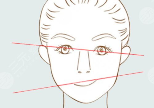 內(nèi)輪廓和外輪廓的位置區(qū)別