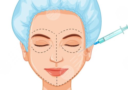 內(nèi)輪廓和外輪廓的位置區(qū)別