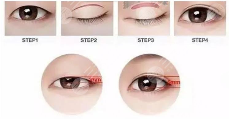 上海九院整形醫(yī)院科普知識(shí)