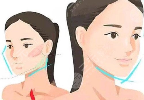 內(nèi)輪廓和外輪廓的位置圖片