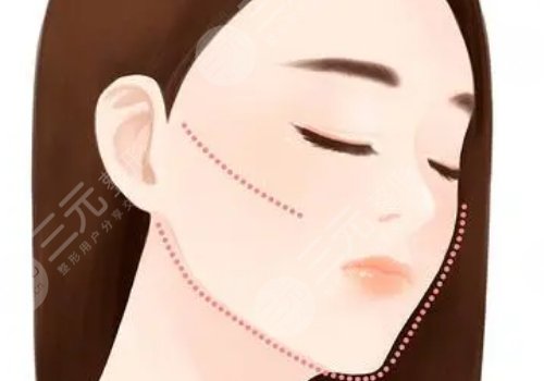 做完輪廓手術(shù)臉更大了怎么回事？