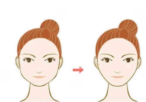 做完輪廓手術(shù)臉更大了怎么回事？