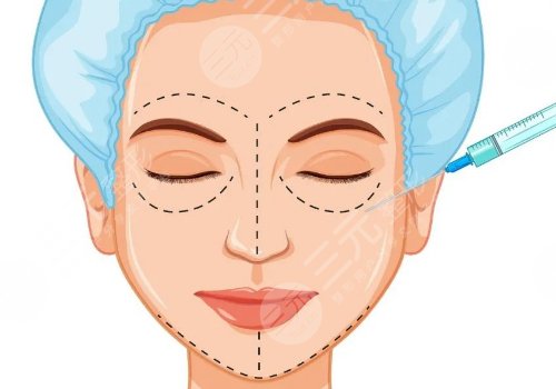 做完輪廓手術(shù)臉更大了怎么回事？