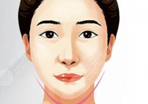 內(nèi)外輪廓固定做手術(shù)要多久？