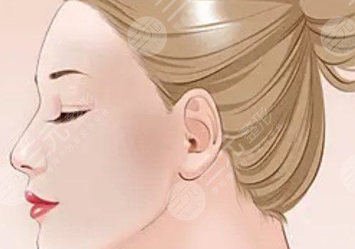 50歲面部提升做什么好