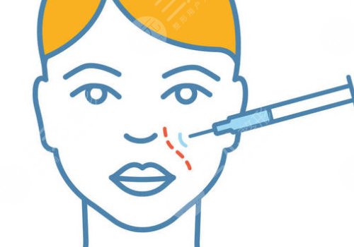 瑞藍(lán)玻尿酸打在哪個(gè)部位？