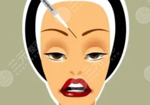 瑞藍(lán)玻尿酸打在哪個(gè)部位？