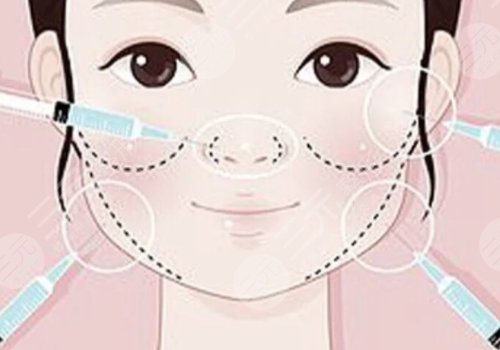 瑞藍(lán)玻尿酸打在哪個(gè)部位？