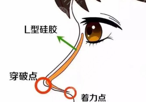 面部整形手術(shù)包括哪些？