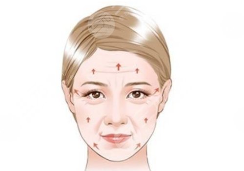 印第安紋是怎么形成的還能消除嗎