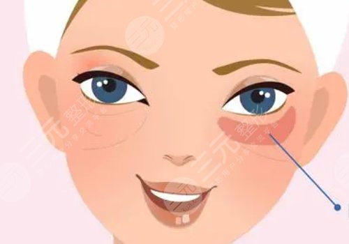 腫眼泡怎么消除？