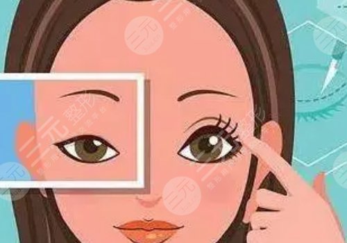 腫眼泡怎么消除？