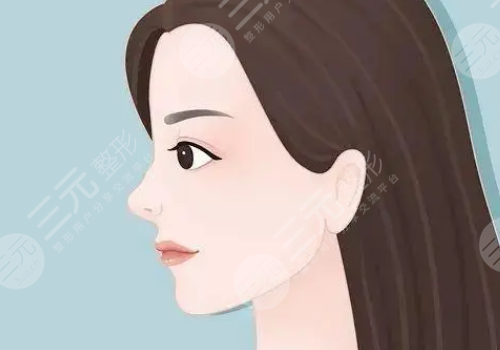 墊鼻基底前后對(duì)比照