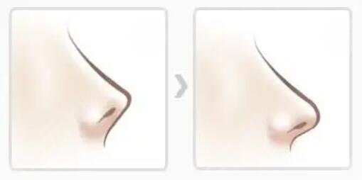 常州二院美容整形科熱門項目