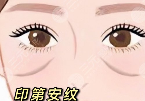 印第安紋和淚溝的區(qū)別是什么？