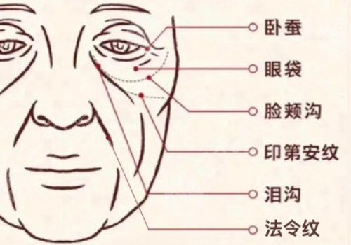 印第安紋和淚溝的區(qū)別是什么？