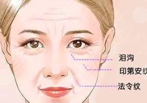 印第安紋和淚溝的區(qū)別是什么？