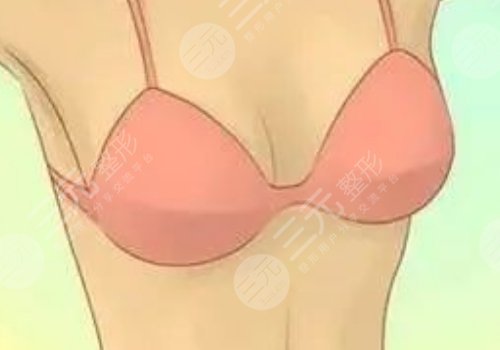 南寧格林美菲整形醫(yī)院做胸怎么樣？