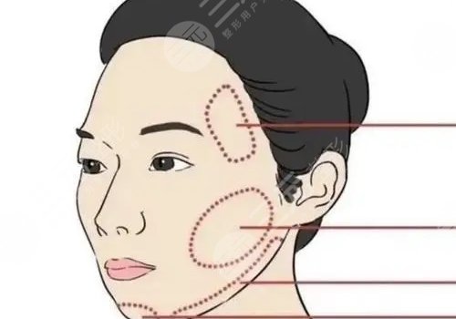 上海磨骨曹棟弼怎么樣？