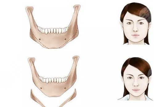 上海磨骨曹棟弼怎么樣？