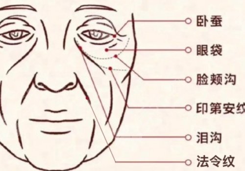 印第安紋填充膠原蛋白和玻尿酸哪個好？