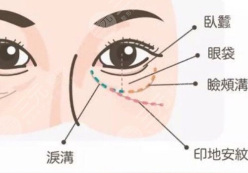 印第安紋填充膠原蛋白和玻尿酸哪個好？