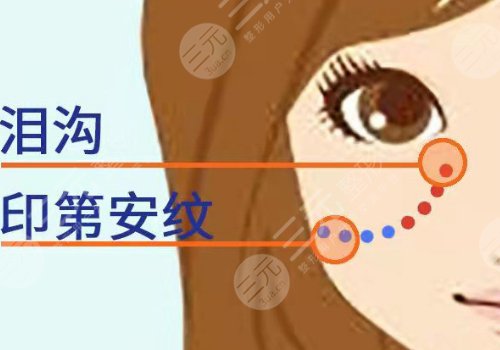 印第安紋填充膠原蛋白和玻尿酸哪個好？