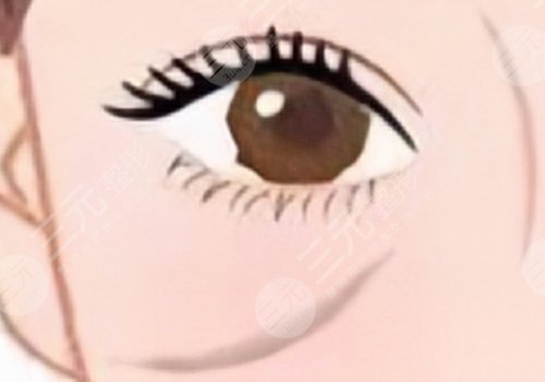 印第安紋填充膠原蛋白和玻尿酸哪個好？