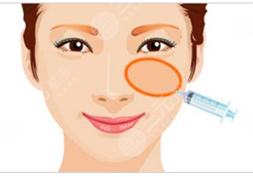 顴骨高有什么辦法改良？