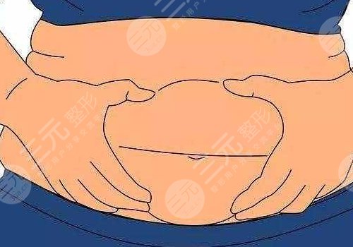 腹部拉皮手術(shù)風(fēng)險大嗎
