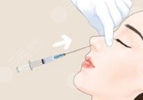 濡白天使隆鼻維持多久？