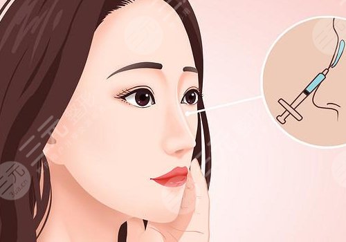 寶尼達隆鼻可以維持多久？