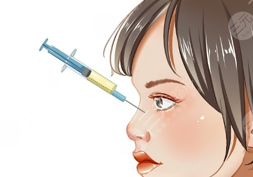 寶尼達隆鼻可以維持多久？