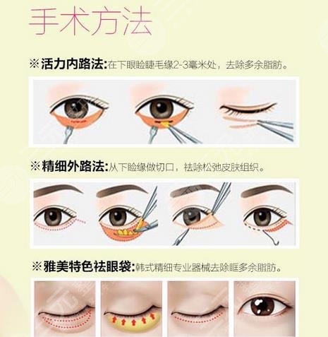 上海華山醫(yī)院整形科擅長項目