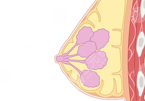 哪種胸型更好看？