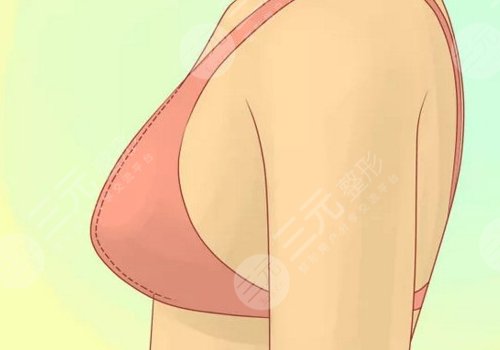 哪種胸型更好看？
