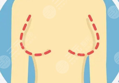 哪種胸型更好看？