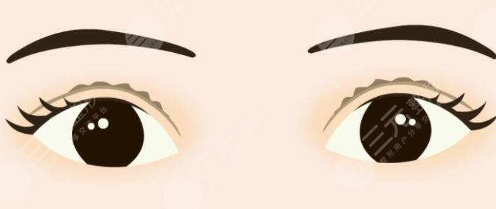 中國醫(yī)學(xué)科學(xué)院整形科雙眼皮案例