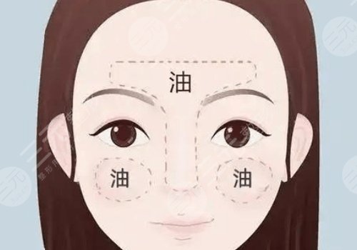 t區(qū)出油毛孔粗大怎么辦？