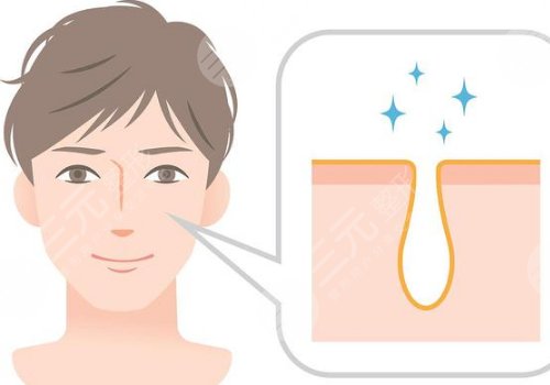 t區(qū)出油毛孔粗大怎么辦？