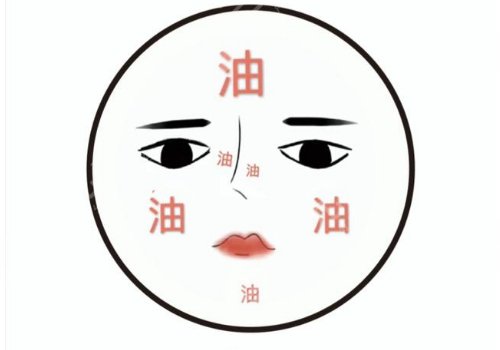 t區(qū)出油毛孔粗大怎么辦？