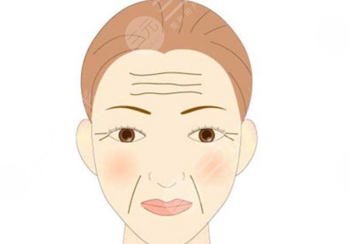 抬頭紋怎么去除？