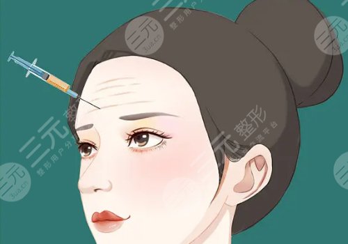 外輪廓提升需要幾支玻尿酸？