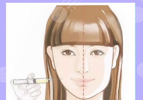 外輪廓提升需要幾支玻尿酸？